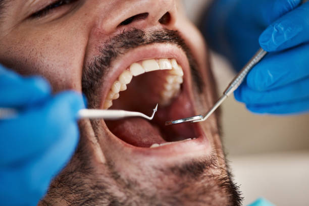 Professional Emergency Dental Service in WA